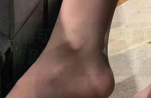 微密圈 - 福利与美的交织：小仙女ELaine裸足写真，引发的思考